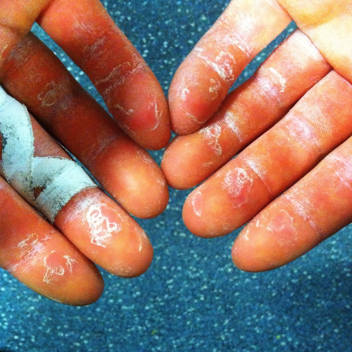 How to Care for Your Climbing Calluses (and prevent flappers) - Just Hand  Stuff